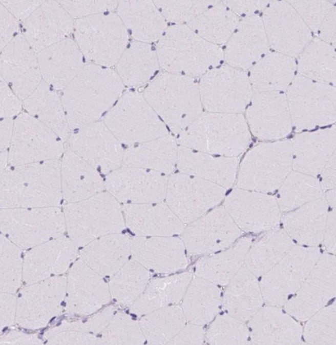 MAP4K6 Antibody - BSA Free