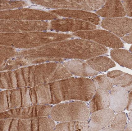 Triadin Antibody