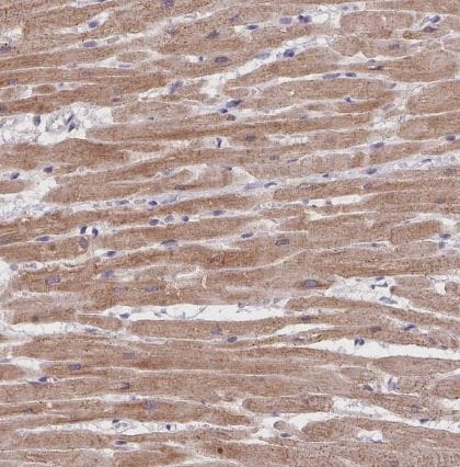 Triadin Antibody