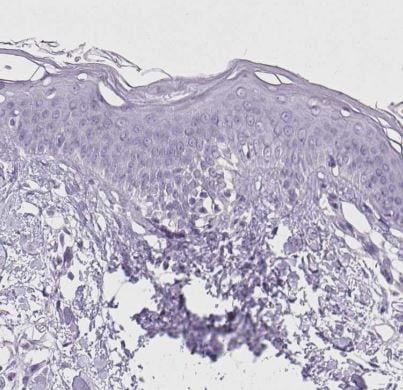 Triadin Antibody
