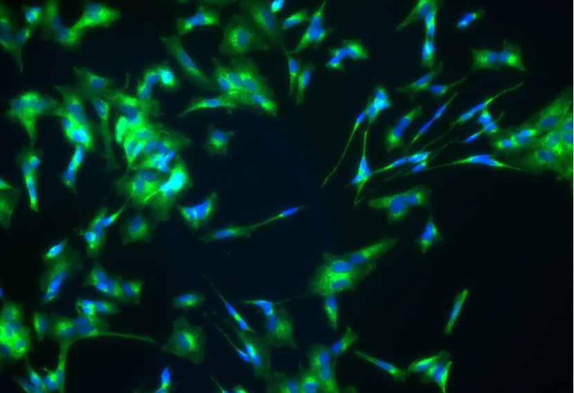 Clathrin Heavy Chain 1/CHC17 Antibody