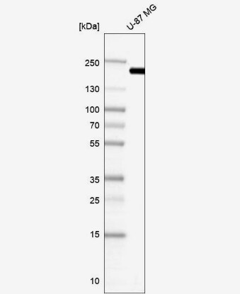Clathrin Heavy Chain 1/CHC17 Antibody