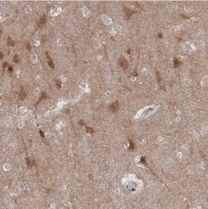 LMO4 Antibody