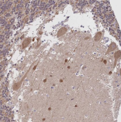 LMO4 Antibody