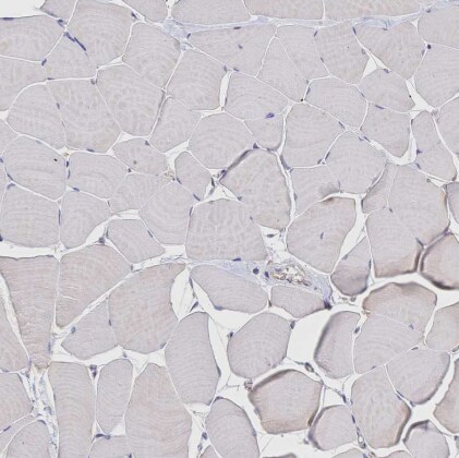 LMO4 Antibody