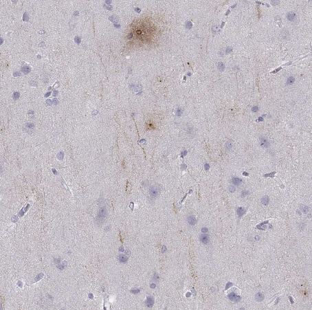 PCSK1N Antibody