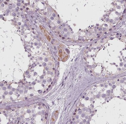 SAMD4A Antibody