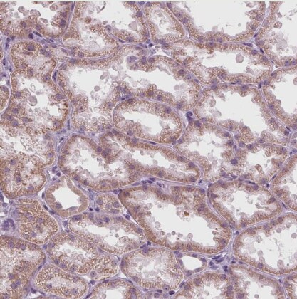 SAMD4A Antibody