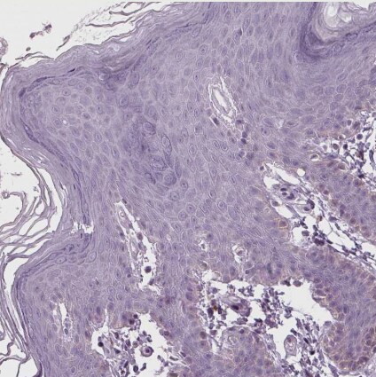 SAMD4A Antibody