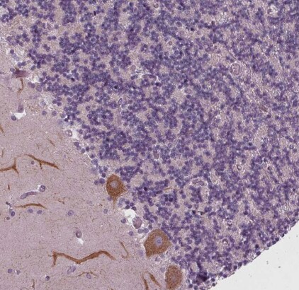 SAMD4A Antibody