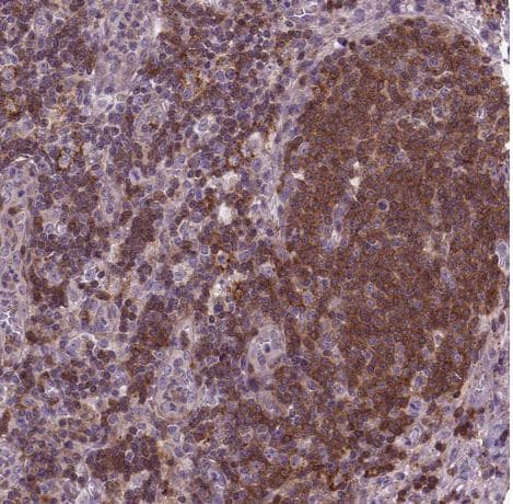 ACAD10 Antibody