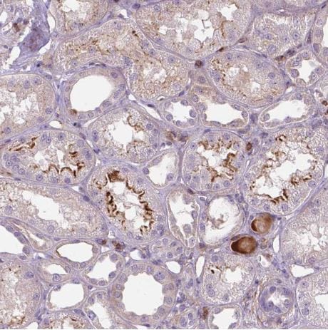 ACAD10 Antibody