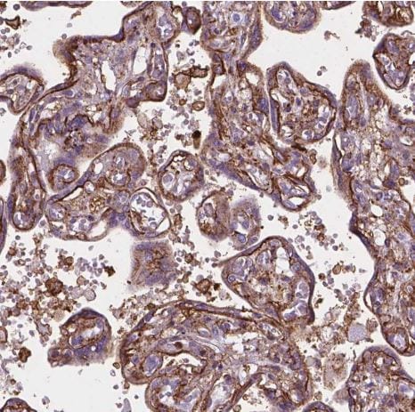 ACAD10 Antibody