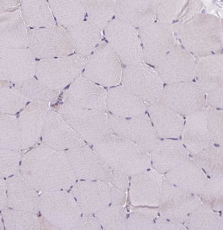 ACAD10 Antibody