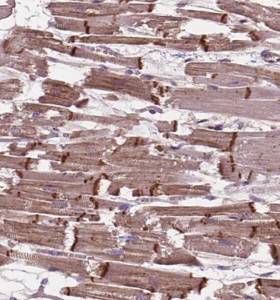 CHMP4A Antibody - BSA Free