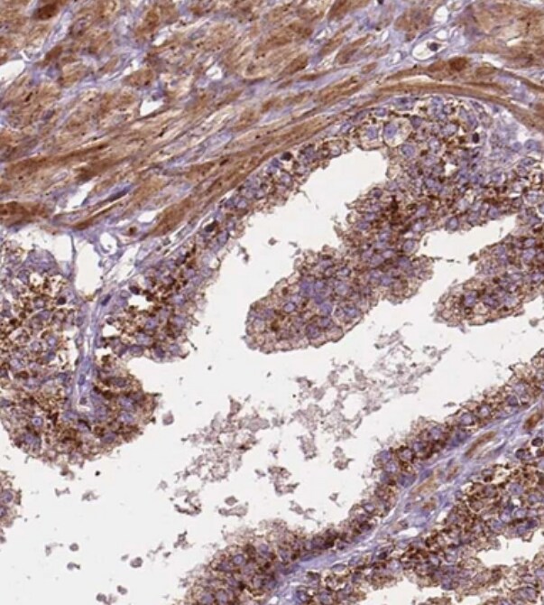 CHMP4A Antibody - BSA Free
