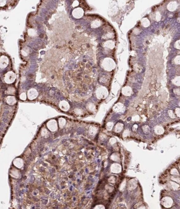 CHMP4A Antibody - BSA Free