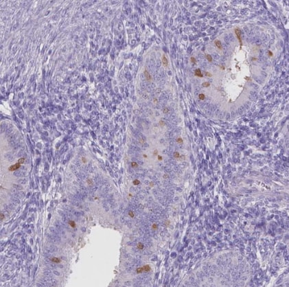 MMP-11 Antibody