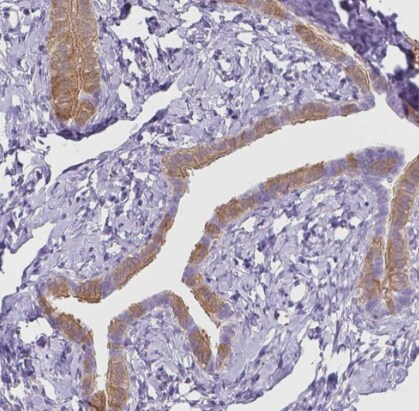 MMP-11 Antibody