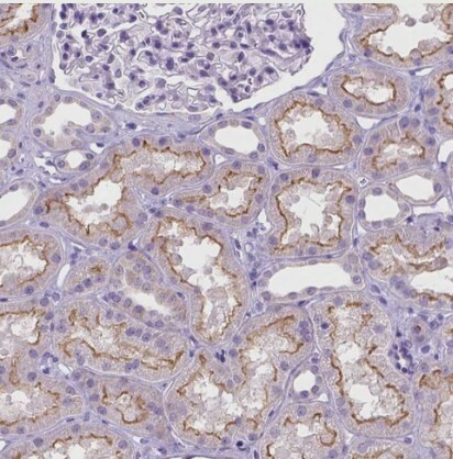 MMP-11 Antibody