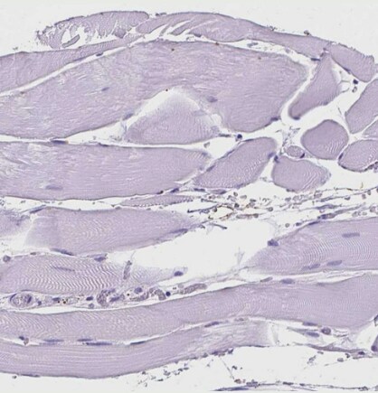 MMP-11 Antibody