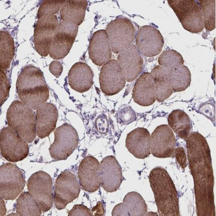 Tau Antibody