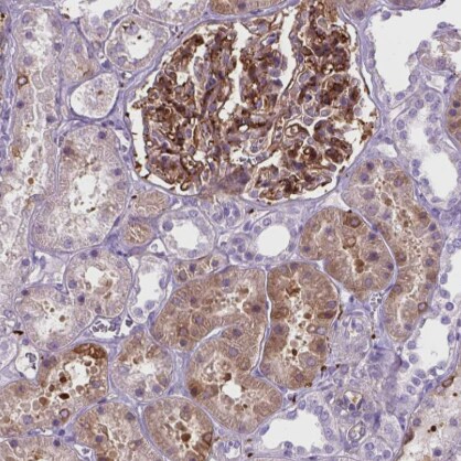 Tau Antibody