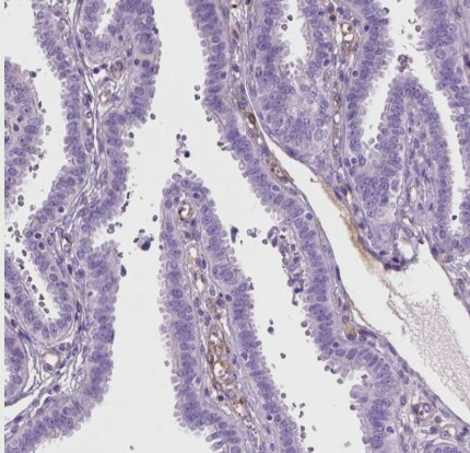 Tau Antibody