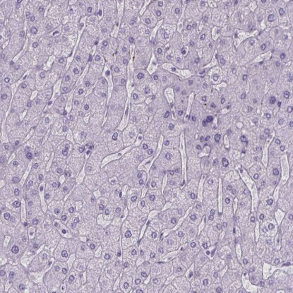 Tau Antibody