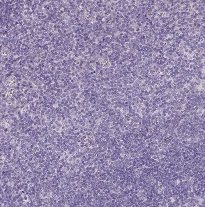 Galactose-3-O-sulfotransferase 2/GAL3ST2 Antibody