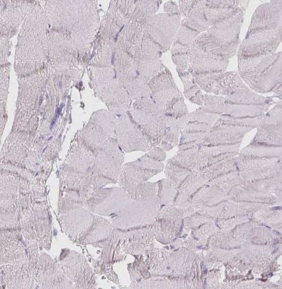 Galactose-3-O-sulfotransferase 2/GAL3ST2 Antibody