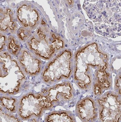 Syntaxin 7 Antibody (CL0257)