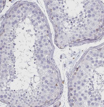 Syntaxin 7 Antibody (CL0257)