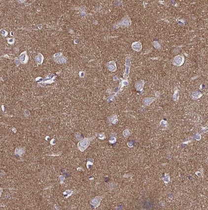 TSPAN7/TM4SF2 Antibody (CL0262)