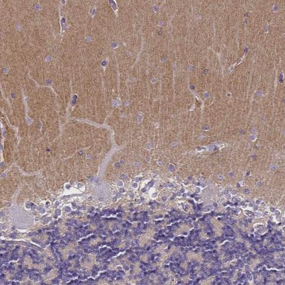 TSPAN7/TM4SF2 Antibody (CL0262)
