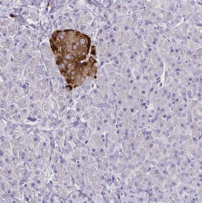 TSPAN7/TM4SF2 Antibody (CL0262)