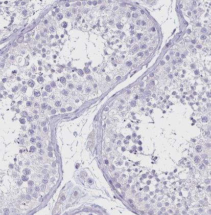 TSPAN7/TM4SF2 Antibody (CL0262)
