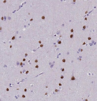 SATB2 Antibody (CL0323) - BSA Free