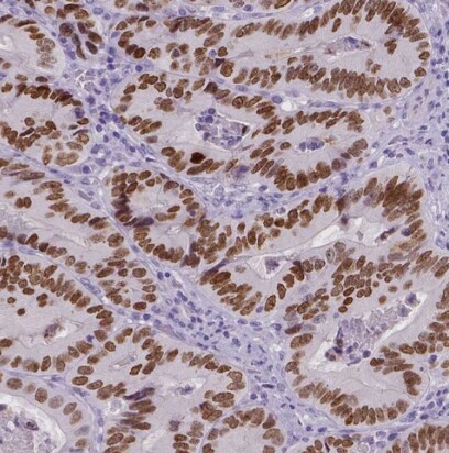 SATB2 Antibody (CL0323) - BSA Free