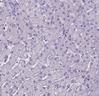 SATB2 Antibody (CL0323) - BSA Free