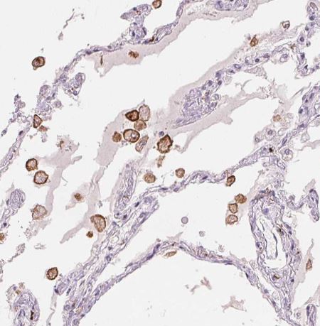 MMR/CD206/Mannose Receptor Antibody (CL0387)
