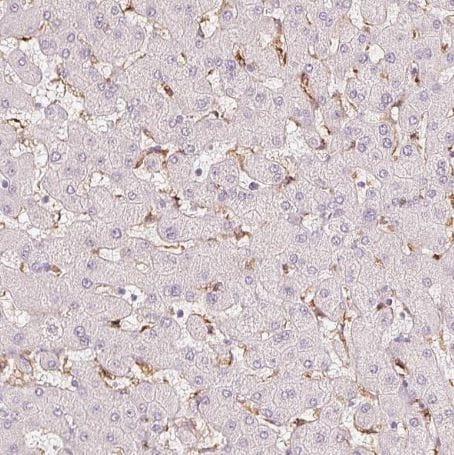 MMR/CD206/Mannose Receptor Antibody (CL0387)