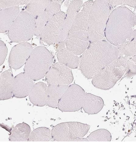 MMR/CD206/Mannose Receptor Antibody (CL0387)