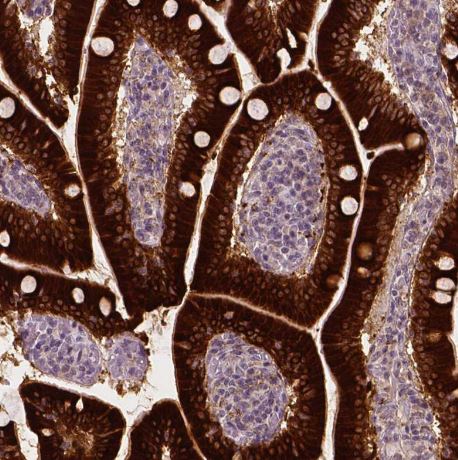 Apolipoprotein A-IV/ApoA4 Antibody (CL0468)
