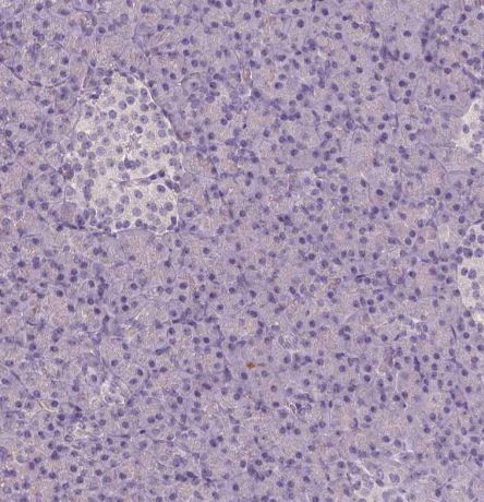 Apolipoprotein A-IV/ApoA4 Antibody (CL0468)