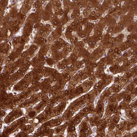 PHGDH Antibody (CL0555)