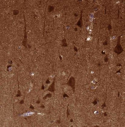 NECAB1 Antibody (CL0575)