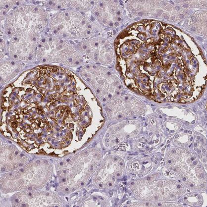 NECAB1 Antibody (CL0575)