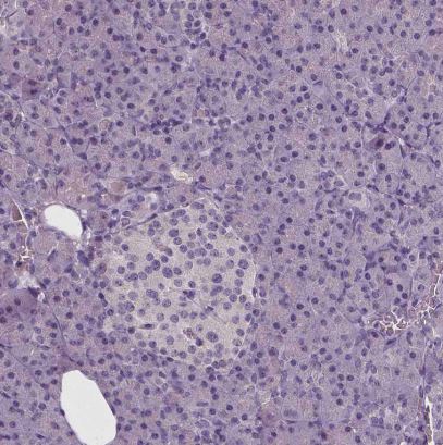 NECAB1 Antibody (CL0575)
