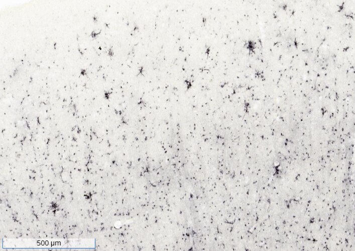 Ferritin Light Chain Antibody (FTL/1386) - Azide and BSA Free Immunohistochemistry-Frozen: Mouse Monoclonal Ferritin Light Chain Antibody (FTL/1386) - Azide and BSA Free [NBP2-54574]